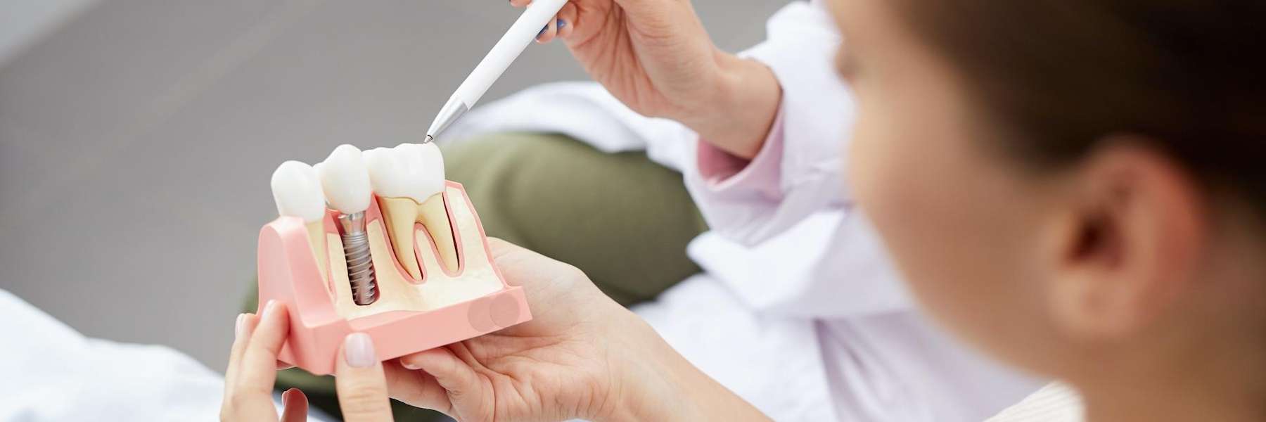 Dental bridges arvada | Dental office Arvada