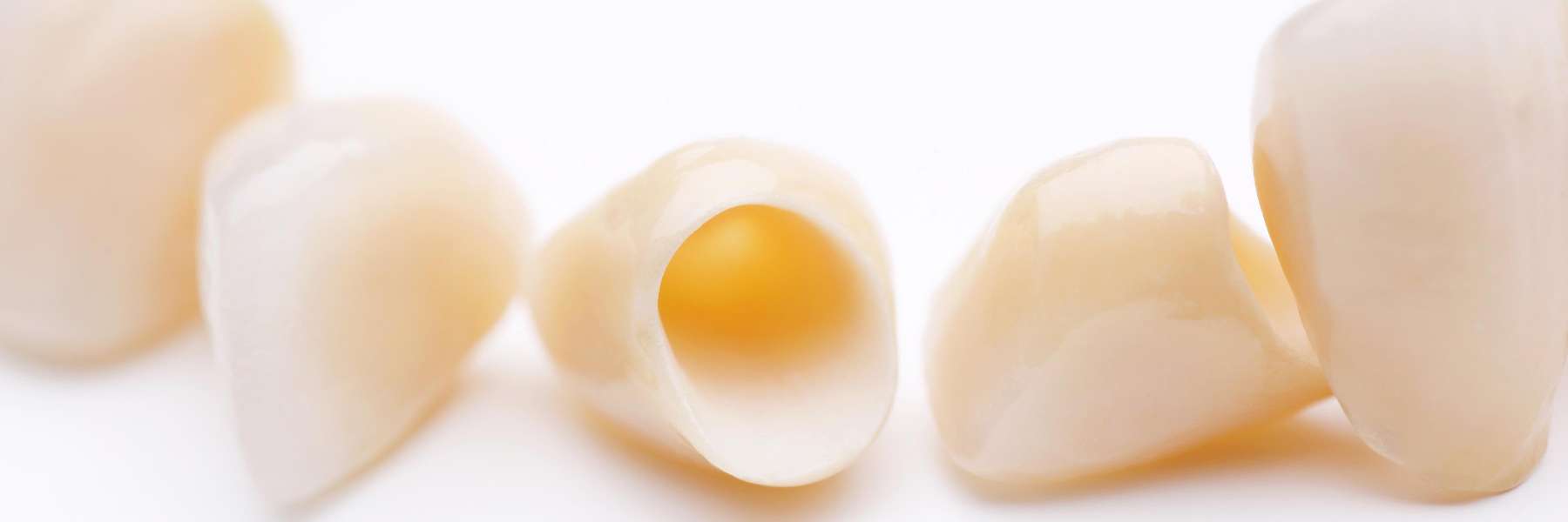 Dental Crowns arvada | arvada dentist