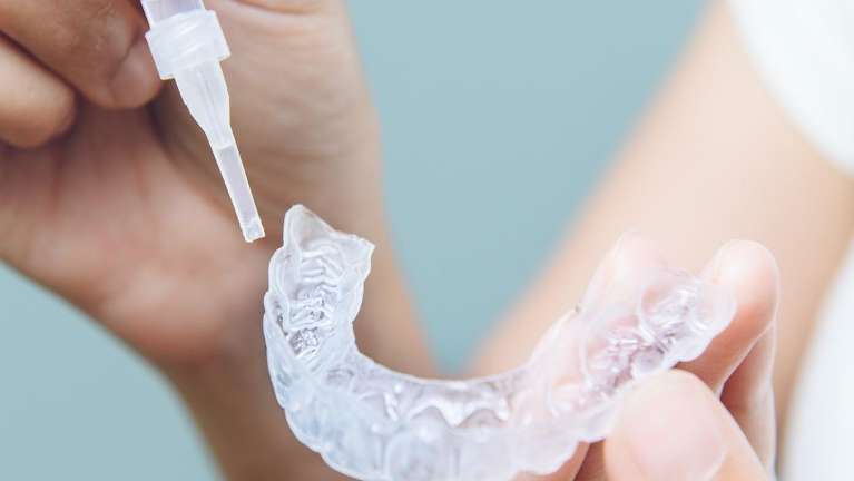 Take-Home Teeth Whitening in Arvada, CO