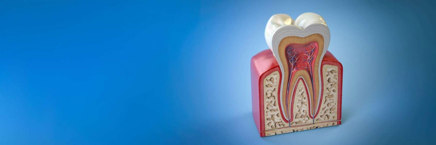 root canal on a teeth illustration