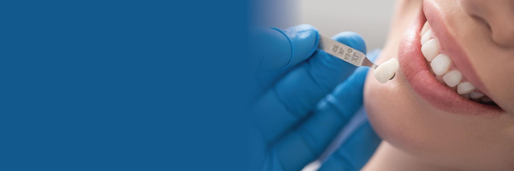 woman getting dental veneers arvada, co